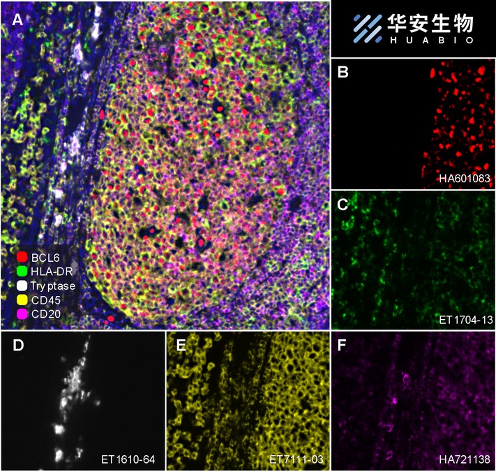 Fluorescence multiplex immunohistochemical analysis of Human tonsil (Formalin/PFA-fixed paraffin-embedded sections). Panel A: the merged image of anti-BCL6 (HA601083, Red), anti-HLA-DR (ET1704-13, Green), anti-Tryptase (ET1610-64, White), anti-CD20 (HA721138, Magenta) and anti-CD45 (ET7111-03, Yellow) on tonsil. HRP Conjugated UltraPolymer Goat Polyclonal Antibody HA1119/HA1120 was used as a secondary antibody. The immunostaining was performed with the Sequential Immuno-staining Kit (IRISKit™MH010101, www.luminiris.cn). The section was incubated in five rounds of staining: in the order of HA601083 (1/200 dilution), ET1704-13 (1/2,000 dilution), ET1610-64 (1/5,000 dilution), HA721138 (1/2,000 dilution) and ET7111-03 (1/500 dilution) for 20 mins at room temperature. Each round was followed by a separate fluorescent tyramide signal amplification system. Heat mediated antigen retrieval with Tris-EDTA buffer (pH 9.0) for 30 mins at 95℃. DAPI (blue) was used as a nuclear counter stain. Image acquisition was performed with Olympus VS200 Slide Scanner.