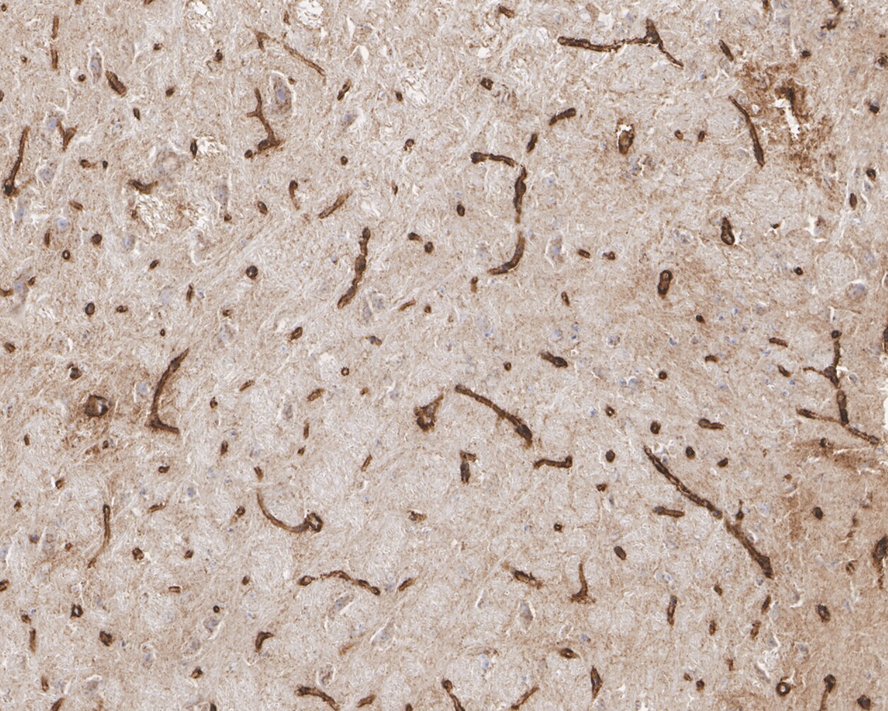 Immunohistochemical analysis of paraffin-embedded AD mouse brain tissue with Rabbit anti-Apolipoprotein E antibody (ET1610-22) at 1/1,000 dilution.<br />
<br />
The section was pre-treated using heat mediated antigen retrieval with Tris-EDTA buffer (pH 9.0) for 20 minutes. The tissues were blocked in 1% BSA for 20 minutes at room temperature, washed with ddH2O and PBS, and then probed with the primary antibody (ET1610-22) at 1/1,000 dilution for 1 hour at room temperature. The detection was performed using an HRP conjugated compact polymer system. DAB was used as the chromogen. Tissues were counterstained with hematoxylin and mounted with DPX.