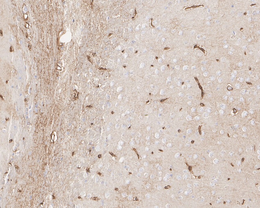 Immunohistochemical analysis of paraffin-embedded mouse brain tissue with Rabbit anti-Apolipoprotein E antibody (ET1610-22) at 1/1,000 dilution.<br />
<br />
The section was pre-treated using heat mediated antigen retrieval with Tris-EDTA buffer (pH 9.0) for 20 minutes. The tissues were blocked in 1% BSA for 20 minutes at room temperature, washed with ddH2O and PBS, and then probed with the primary antibody (ET1610-22) at 1/1,000 dilution for 1 hour at room temperature. The detection was performed using an HRP conjugated compact polymer system. DAB was used as the chromogen. Tissues were counterstained with hematoxylin and mounted with DPX.