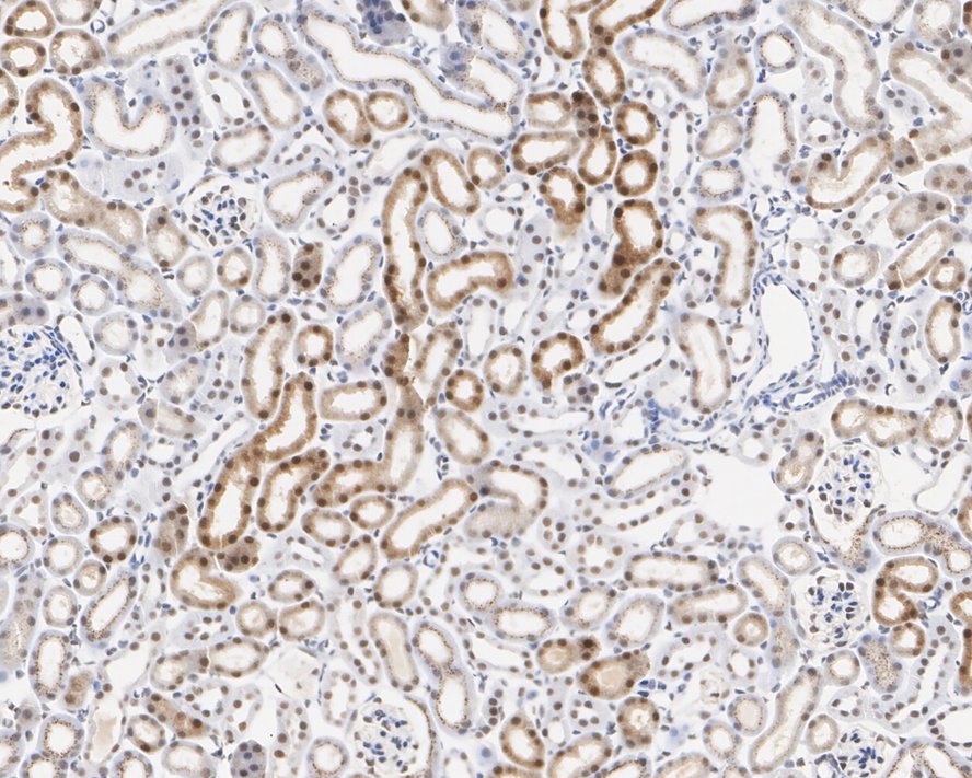 Immunohistochemical analysis of paraffin-embedded mouse kidney tissue with Rabbit anti-NR1D1 antibody (ET7106-92) at 1/200 dilution.<br />
<br />
The section was pre-treated using heat mediated antigen retrieval with sodium citrate buffer (pH 6.0) for 2 minutes. The tissues were blocked in 1% BSA for 20 minutes at room temperature, washed with ddH2O and PBS, and then probed with the primary antibody (ET7106-92) at 1/200 dilution for 1 hour at room temperature. The detection was performed using an HRP conjugated compact polymer system. DAB was used as the chromogen. Tissues were counterstained with hematoxylin and mounted with DPX.