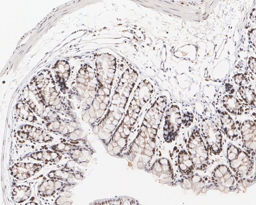 Immunohistochemical analysis of paraffin-embedded mouse colon tissue with Mouse anti-MSH2 antibody (EM1801-05) at 1/1,000 dilution.<br />
<br />
The section was pre-treated using heat mediated antigen retrieval with sodium citrate buffer (pH 6.0) for 2 minutes. The tissues were blocked in 1% BSA for 20 minutes at room temperature, washed with ddH2O and PBS, and then probed with the primary antibody (EM1801-05) at 1/1,000 dilution for 1 hour at room temperature. The detection was performed using an HRP conjugated compact polymer system. DAB was used as the chromogen. Tissues were counterstained with hematoxylin and mounted with DPX.