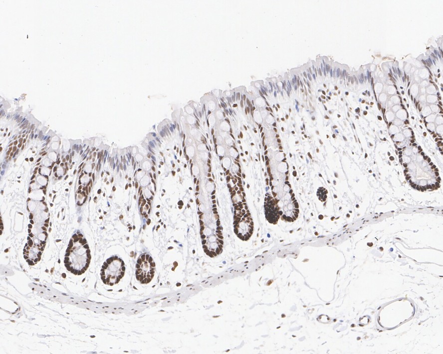 Immunohistochemical analysis of paraffin-embedded rat colon tissue with Mouse anti-MSH2 antibody (EM1801-05) at 1/1,000 dilution.<br />
<br />
The section was pre-treated using heat mediated antigen retrieval with sodium citrate buffer (pH 6.0) for 2 minutes. The tissues were blocked in 1% BSA for 20 minutes at room temperature, washed with ddH2O and PBS, and then probed with the primary antibody (EM1801-05) at 1/1,000 dilution for 1 hour at room temperature. The detection was performed using an HRP conjugated compact polymer system. DAB was used as the chromogen. Tissues were counterstained with hematoxylin and mounted with DPX.