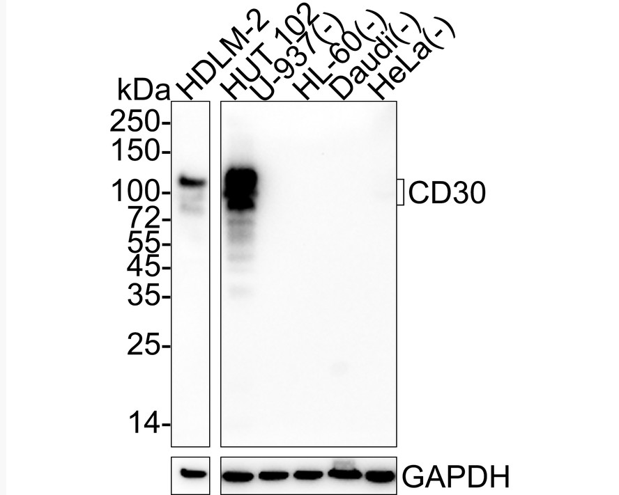 CD30 Recombinant Rabbit Monoclonal Antibody [PSH04-12] (HA722093) – HUABIO