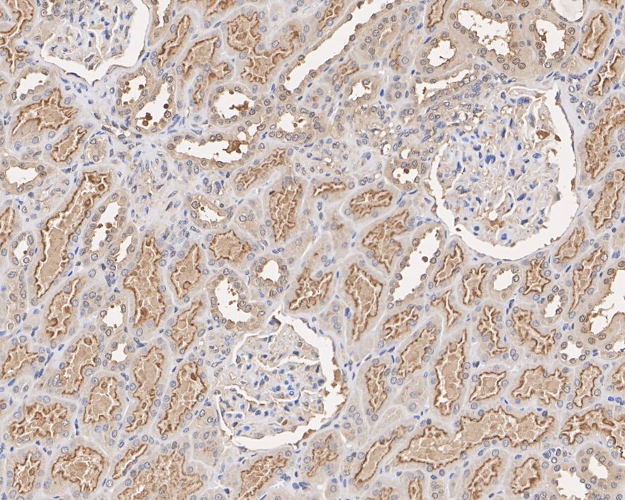 Immunohistochemical analysis of paraffin-embedded human kidney tissue with Mouse anti-KIAA0100 antibody (M1210-6) at 1/2,000 dilution.<br />
<br />
The section was pre-treated using heat mediated antigen retrieval with Tris-EDTA buffer (pH 9.0) for 20 minutes. The tissues were blocked in 1% BSA for 20 minutes at room temperature, washed with ddH2O and PBS, and then probed with the primary antibody (M1210-6) at 1/2,000 dilution for 1 hour at room temperature. The detection was performed using an HRP conjugated compact polymer system. DAB was used as the chromogen. Tissues were counterstained with hematoxylin and mounted with DPX.