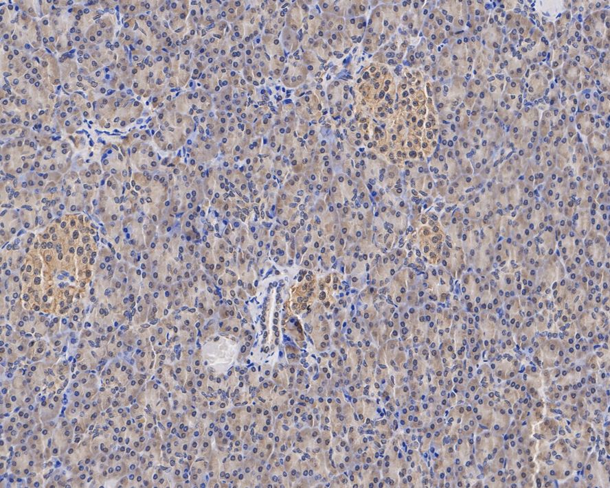 Immunohistochemical analysis of paraffin-embedded human pancreas tissue with Mouse anti-KIAA0100 antibody (M1210-6) at 1/2,000 dilution.<br />
<br />
The section was pre-treated using heat mediated antigen retrieval with Tris-EDTA buffer (pH 9.0) for 20 minutes. The tissues were blocked in 1% BSA for 20 minutes at room temperature, washed with ddH2O and PBS, and then probed with the primary antibody (M1210-6) at 1/2,000 dilution for 1 hour at room temperature. The detection was performed using an HRP conjugated compact polymer system. DAB was used as the chromogen. Tissues were counterstained with hematoxylin and mounted with DPX.