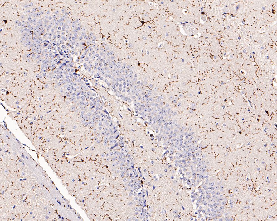 Immunohistochemical analysis of paraffin-embedded rat brain tissue with Rabbit anti-Iba1 antibody (ET1705-78) at 1/1,000 dilution.<br />
<br />
The section was pre-treated using heat mediated antigen retrieval with Tris-EDTA buffer (pH 9.0) for 20 minutes. The tissues were blocked in 1% BSA for 20 minutes at room temperature, washed with ddH2O and PBS, and then probed with the primary antibody (ET1705-78) at 1/1,000 dilution for 1 hour at room temperature. The detection was performed using an HRP conjugated compact polymer system. DAB was used as the chromogen. Tissues were counterstained with hematoxylin and mounted with DPX.