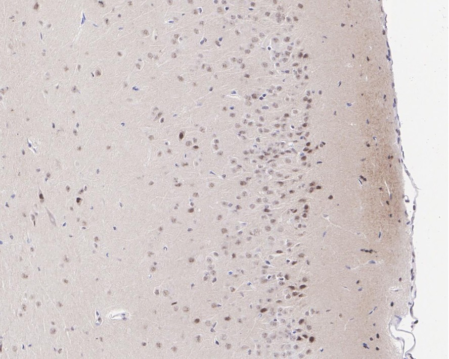 Immunohistochemical analysis of paraffin-embedded mouse brain tissue with Rabbit anti-Phospho-MEK1 (T292) antibody (ET1612-42) at 1/200 dilution.<br />
<br />
The section was pre-treated using heat mediated antigen retrieval with Tris-EDTA buffer (pH 9.0) for 20 minutes. The tissues were blocked in 1% BSA for 20 minutes at room temperature, washed with ddH2O and PBS, and then probed with the primary antibody (ET1612-42) at 1/200 dilution for 1 hour at room temperature. The detection was performed using an HRP conjugated compact polymer system. DAB was used as the chromogen. Tissues were counterstained with hematoxylin and mounted with DPX.