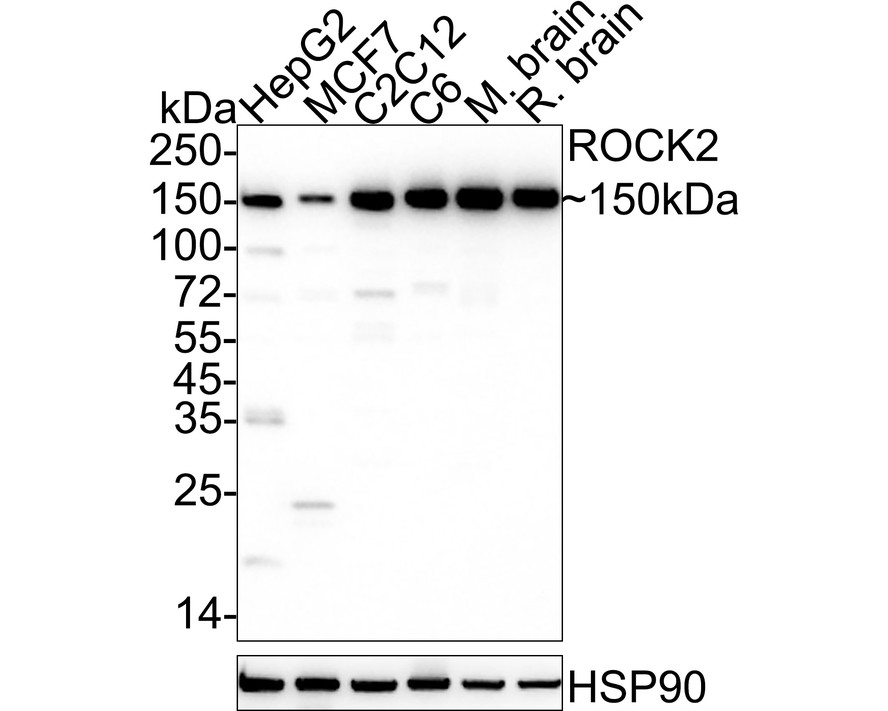 ROCK2 Recombinant Rabbit Monoclonal Antibody [JE31-36] (HA722176) – HUABIO