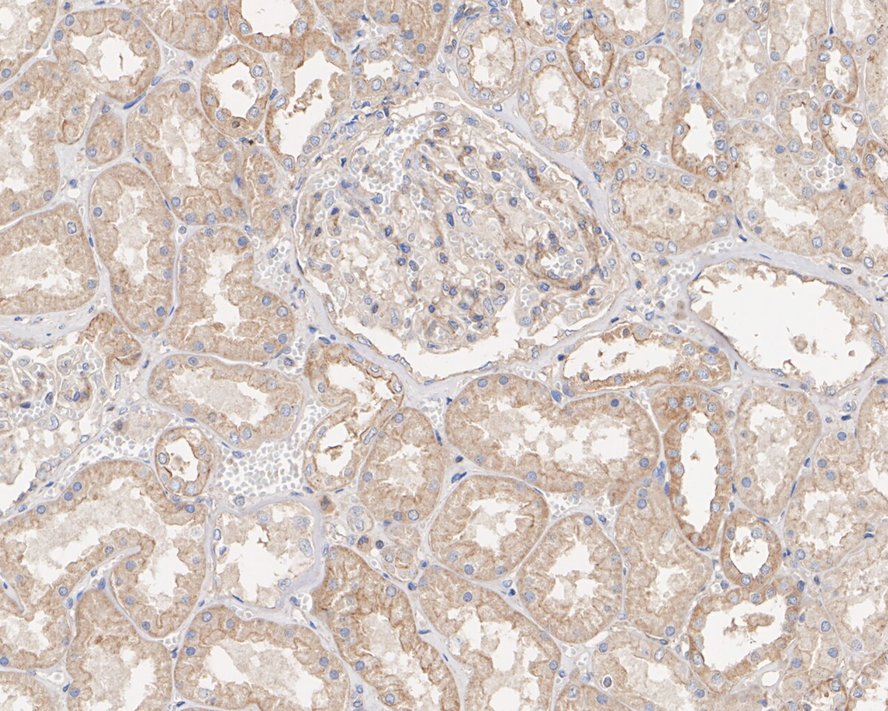 Immunohistochemical analysis of paraffin-embedded human kidney tissue with Mouse anti-CD151 antibody (HA600059) at 1/500 dilution.<br />
<br />
The section was pre-treated using heat mediated antigen retrieval with Tris-EDTA buffer (pH 9.0) for 20 minutes. The tissues were blocked in 1% BSA for 20 minutes at room temperature, washed with ddH2O and PBS, and then probed with the primary antibody (HA600059) at 1/500 dilution for 1 hour at room temperature. The detection was performed using an HRP conjugated compact polymer system. DAB was used as the chromogen. Tissues were counterstained with hematoxylin and mounted with DPX.