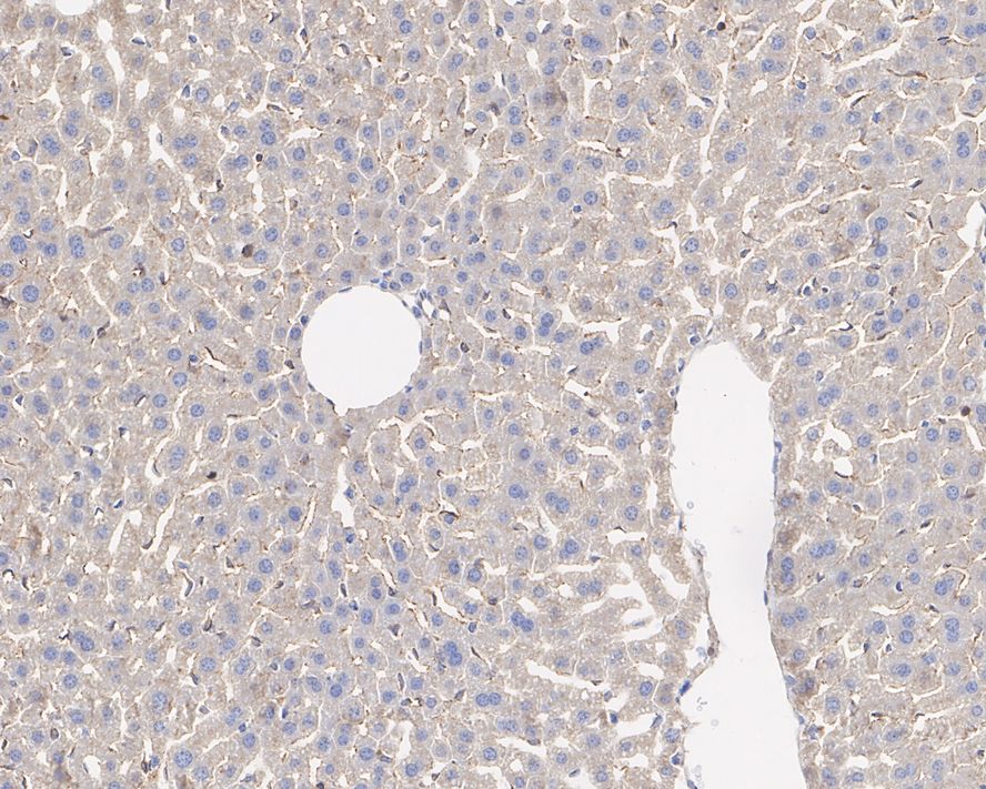 Immunohistochemical analysis of paraffin-embedded mouse liver tissue with Mouse anti-CD151 antibody (HA600059) at 1/500 dilution.<br />
<br />
The section was pre-treated using heat mediated antigen retrieval with Tris-EDTA buffer (pH 9.0) for 20 minutes. The tissues were blocked in 1% BSA for 20 minutes at room temperature, washed with ddH2O and PBS, and then probed with the primary antibody (HA600059) at 1/500 dilution for 1 hour at room temperature. The detection was performed using an HRP conjugated compact polymer system. DAB was used as the chromogen. Tissues were counterstained with hematoxylin and mounted with DPX.