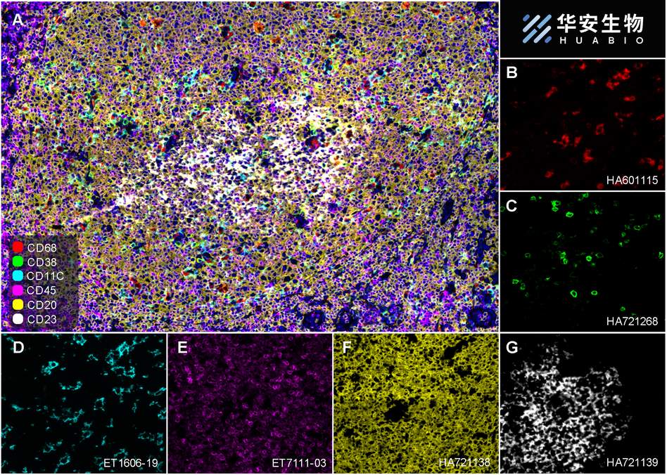 Fluorescence multiplex immunohistochemical analysis of Human tonsil (Formalin/PFA-fixed paraffin-embedded sections). Panel A: the merged image of anti-CD68 (HA601115, Red), anti-CD38 (HA721268, Green), anti-CD23 (HA721139, White), anti-CD11C (ET1606-19, Cyan), anti-CD45 (ET7111-03, Magenta) and anti-CD20 (HA721138, Yellow) on tonsil. Panel B: anti-CD68 stained on Macrophage. Panel C: anti-CD38 stained on lymphocyte subsets. Panel D: anti-CD11C stained on dendritic cells. Panel E: CD45 stained on lymphocytes. Panel F: anti-CD20 stained on B cells. Panel G: anti-CD23 stained on follicular dendritic cells. HRP Conjugated UltraPolymer Goat Polyclonal Antibody HA1119/HA1120 was used as a secondary antibody. The immunostaining was performed with the Sequential Immuno-staining Kit (IRISKit™MH010101, www.luminiris.cn). The section was incubated in six rounds of staining: in the order of HA601115 (1/2,000 dilution), HA721268 (1/1,000 dilution), ET1606-19 (1/1,000 dilution), ET7111-03 (1/500 dilution), HA721138 (1/2,000 dilution) and HA721139 (1/800 dilution) for 20 mins at room temperature. Each round was followed by a separate fluorescent tyramide signal amplification system. Heat mediated antigen retrieval with Tris-EDTA buffer (pH 9.0) for 30 mins at 95℃. DAPI (blue) was used as a nuclear counter stain. Image acquisition was performed with Olympus VS200 Slide Scanner.