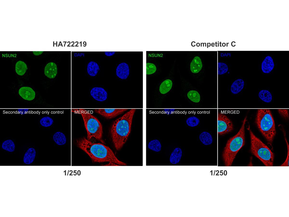 NSUN2 Recombinant Rabbit Monoclonal Antibody [PSH05-05] (HA722219) – HUABIO