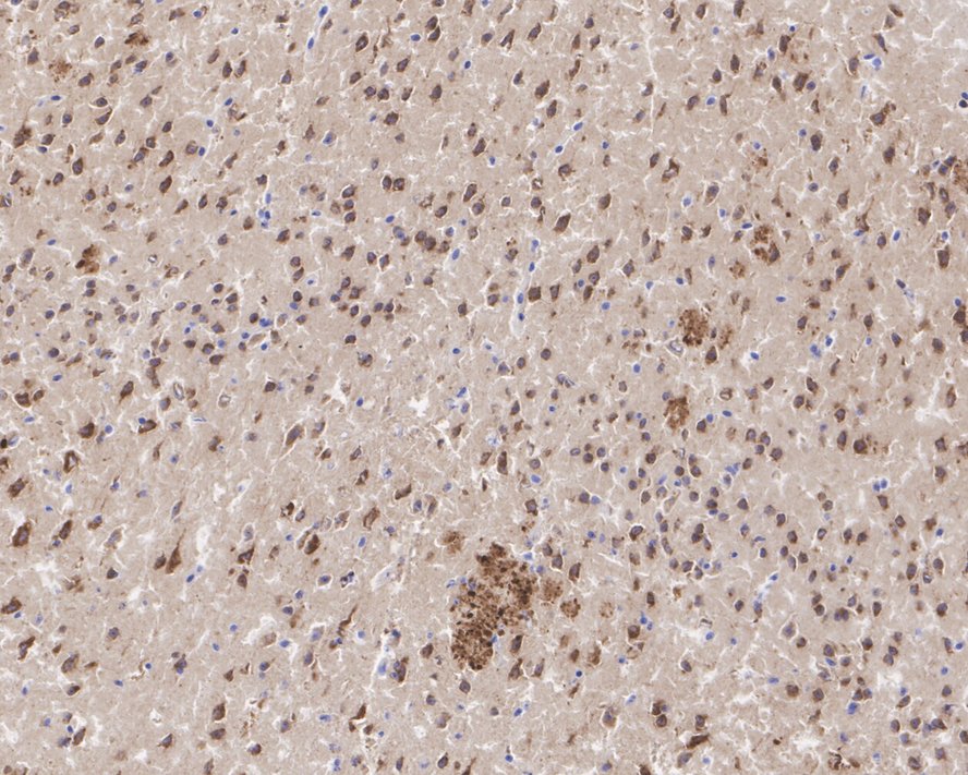 Amyloid Beta A4 Precursor App Recombinant Rabbit Monoclonal Antibody