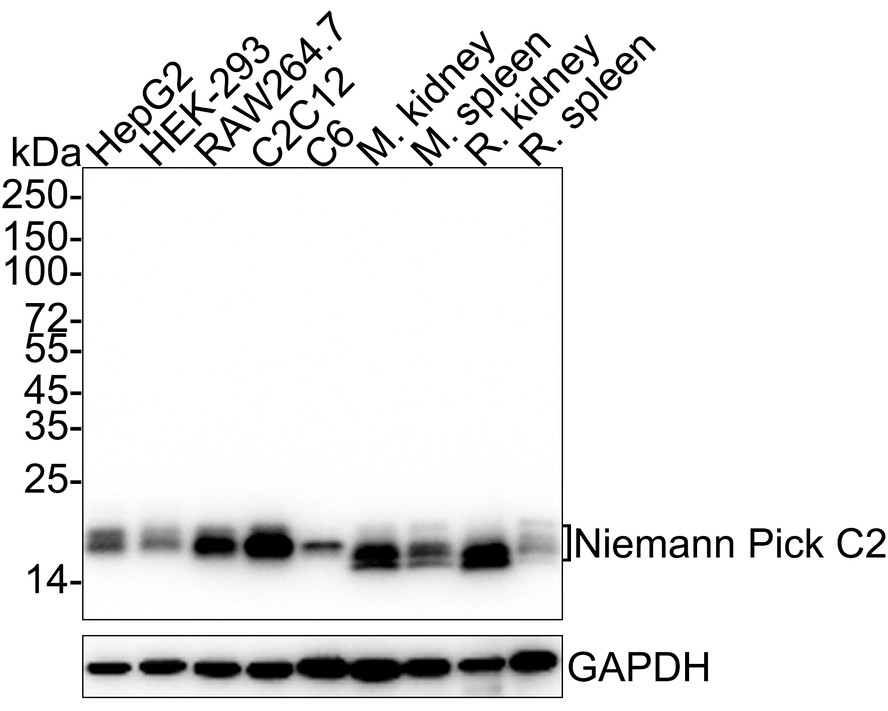 Niemann Pick C2 Recombinant Rabbit Monoclonal Antibody [PSH05-52] (HA7 ...