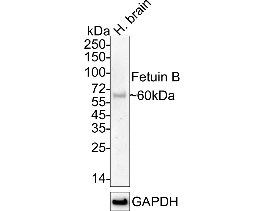 Fetuin B Recombinant Rabbit Monoclonal Antibody [JE75-26] (HA722368 ...