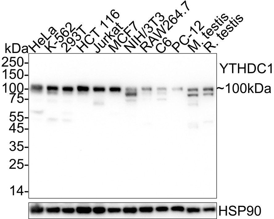 YTHDC1 Recombinant Rabbit Monoclonal Antibody [PSH06-27] – HUABIO