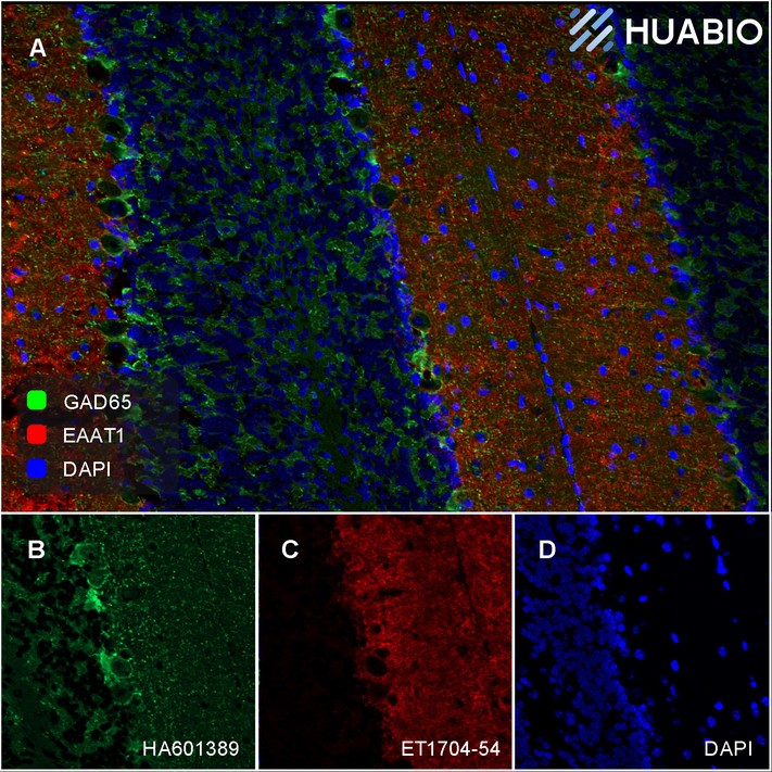 Gad65 Recombinant Antibody [psh06-80] - Rat Igg1 (chimeric) (ha601389 