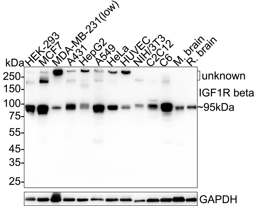 IGF1 Receptor beta Recombinant Rabbit Monoclonal Antibody [PSH11-72 ...