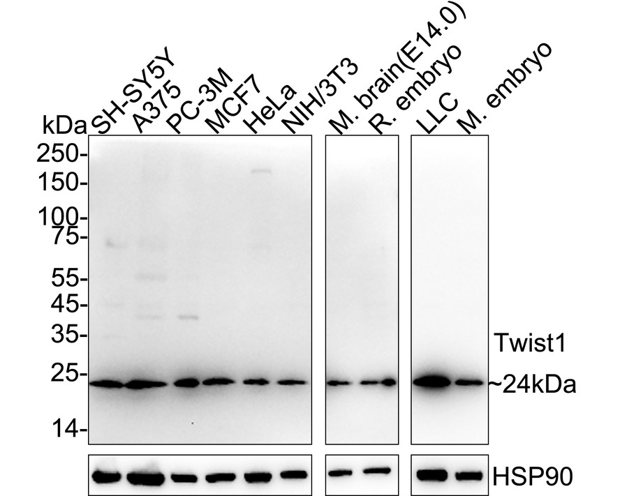 Twist1 Recombinant Rabbit Monoclonal Antibody [PSH11-98] (HA723411 ...