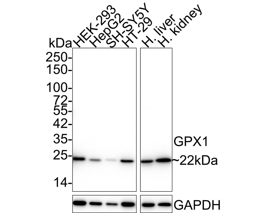Glutathione metabolism Antibody Sampler Kit (HAK21181)  HUABIO