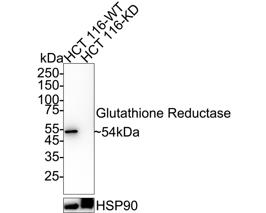 Glutathione metabolism Antibody Sampler Kit (HAK21181)  HUABIO