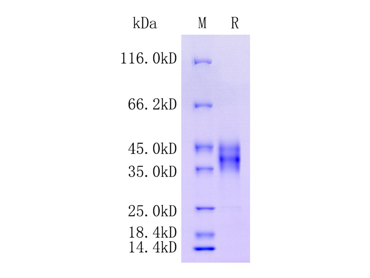 Human Follistatin, Tag Free Protein (HA211463) – HUABIO
