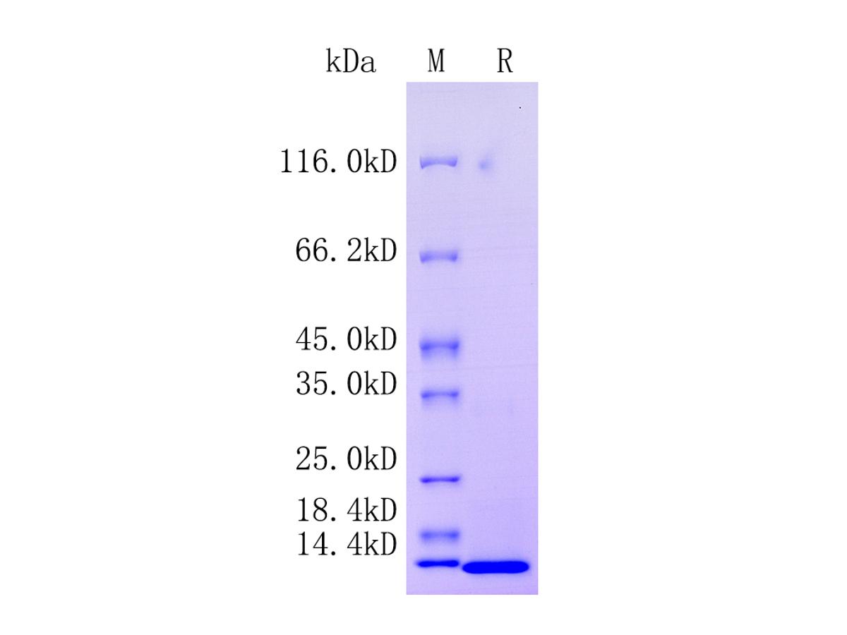 Human Prokineticin-1/PROK1, Tag Free Protein (HA211535) – HUABIO