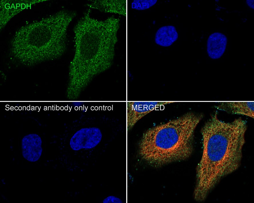 EM1101_2.jpg