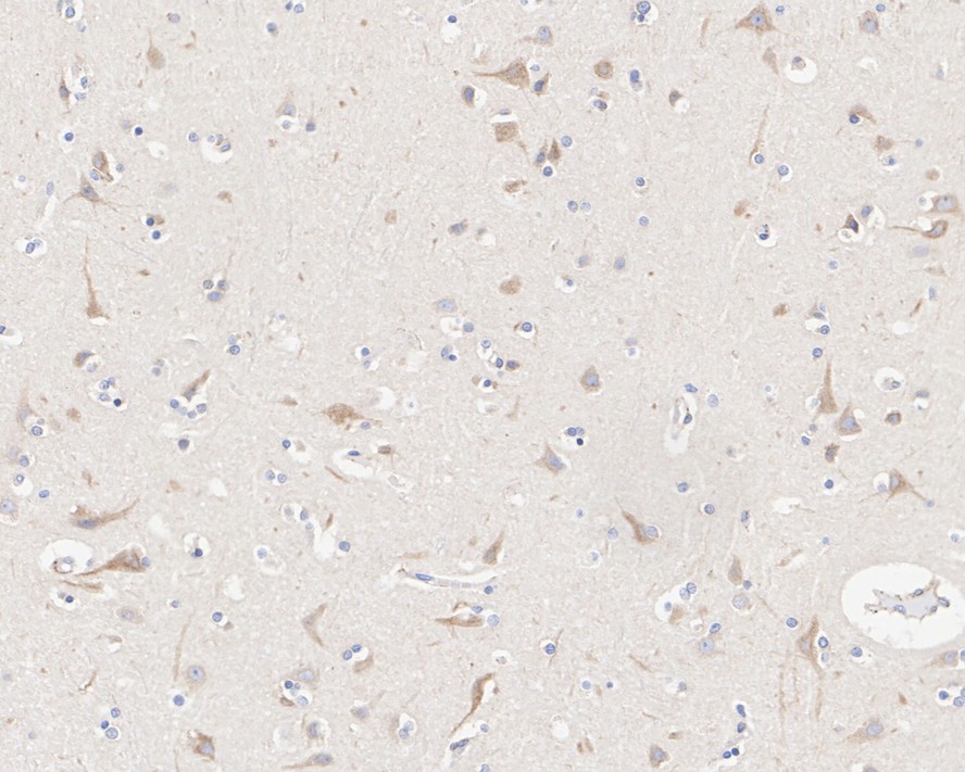 EM1701-57_2.jpg