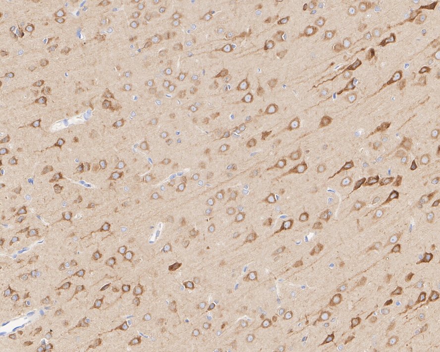 EM1701-57_6.jpg
