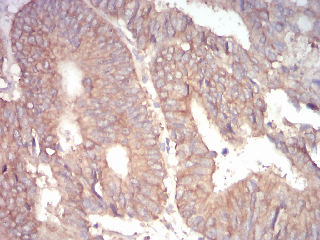 EM1706-63_4.jpg