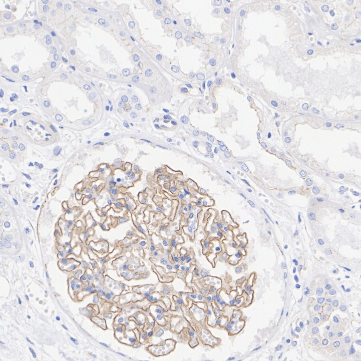 ER41204_2.jpg