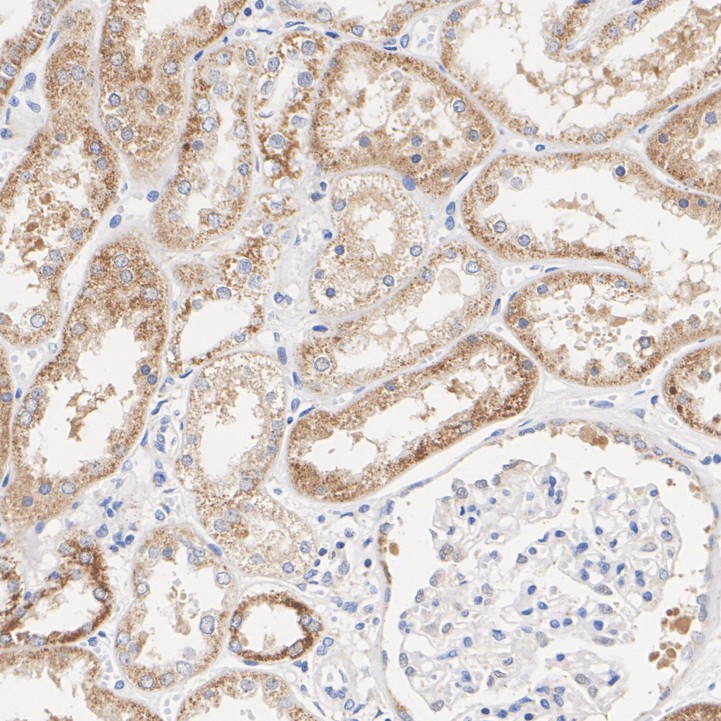 ER61893_3.jpg