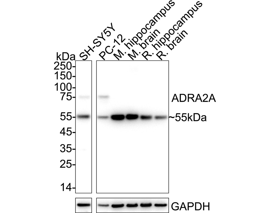 ER62703_1.jpg