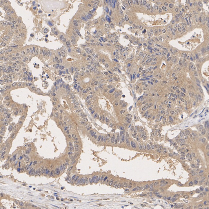 ER62759_2.jpg