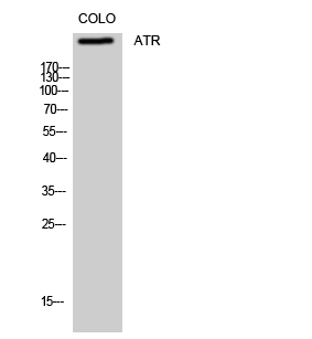 ER62776_1.jpg