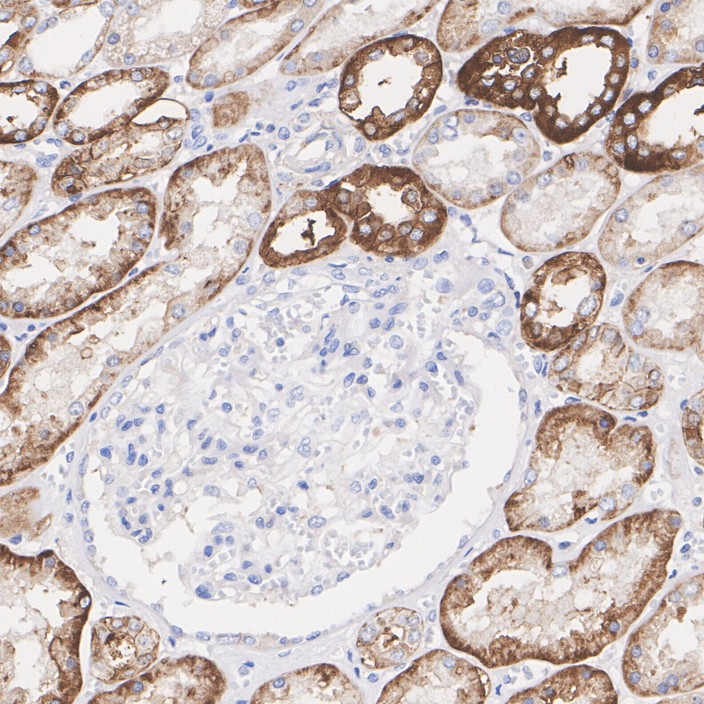 ER62856_3.jpg