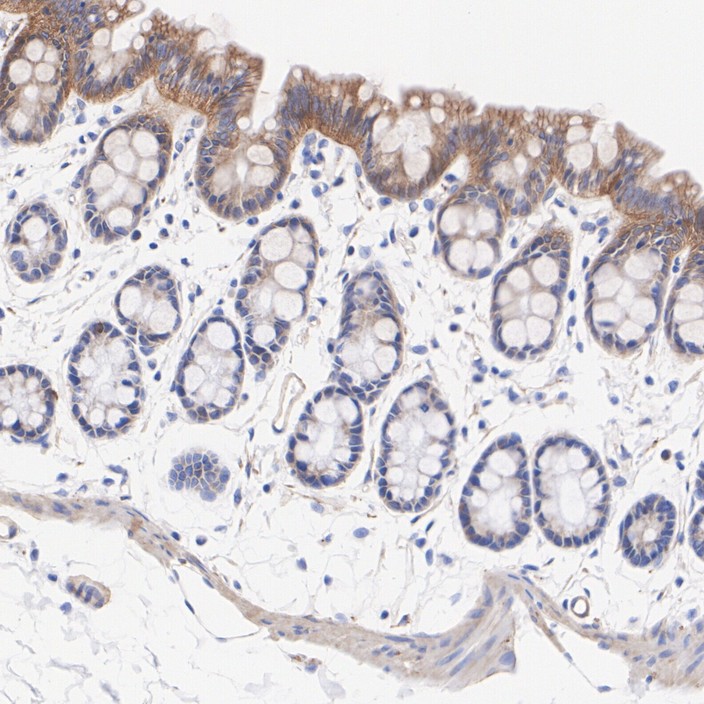 ER62856_6.jpg