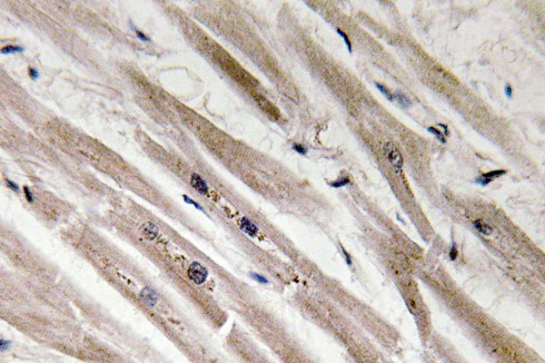 ER62907_2.jpg