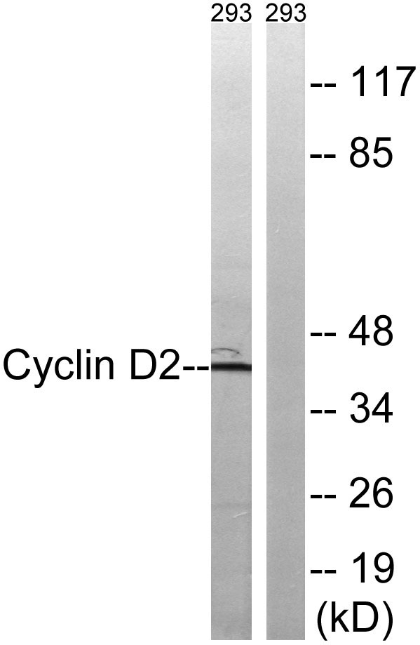 ER63155_1.jpg