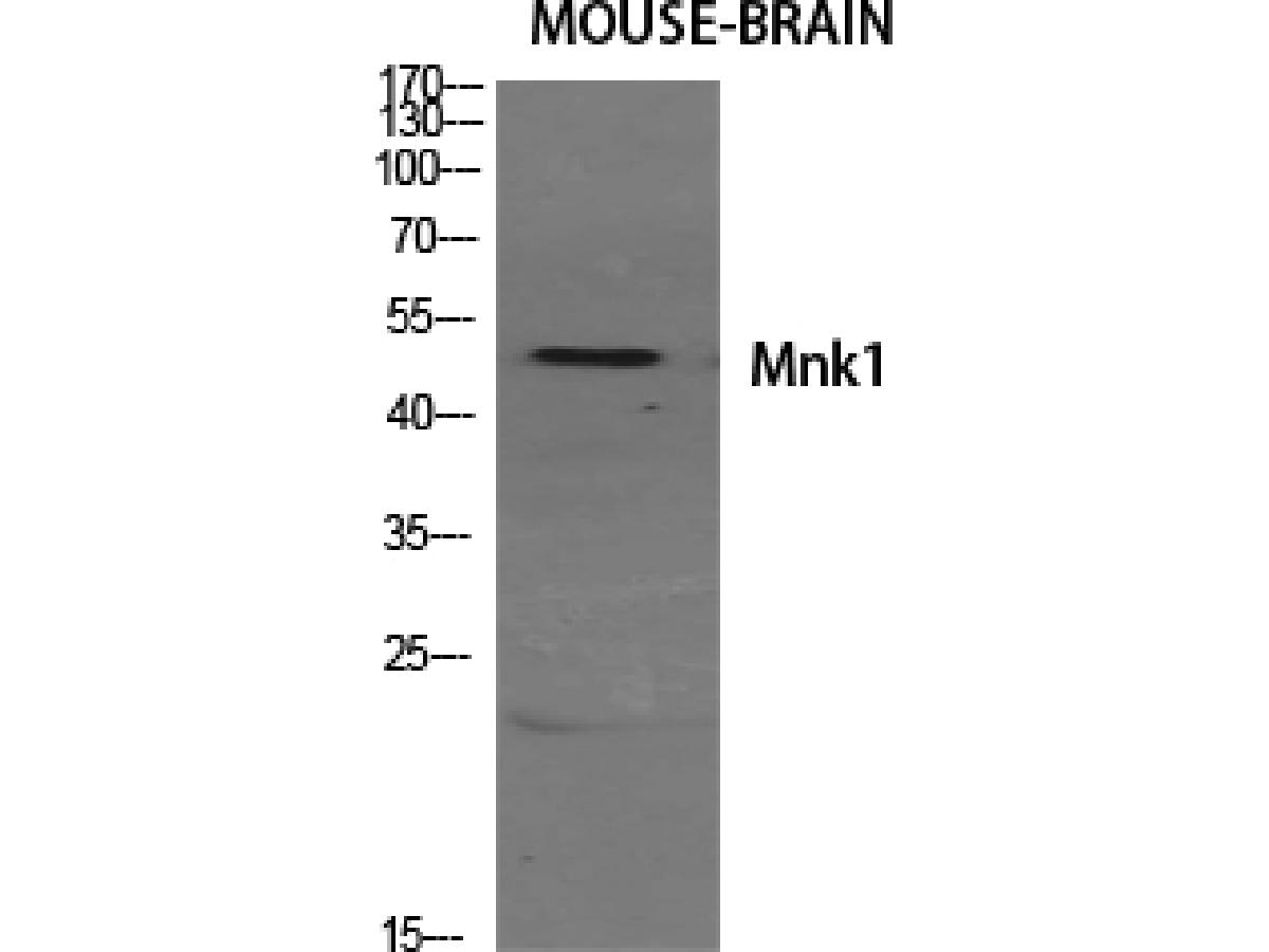 ER63984_1.JPG
