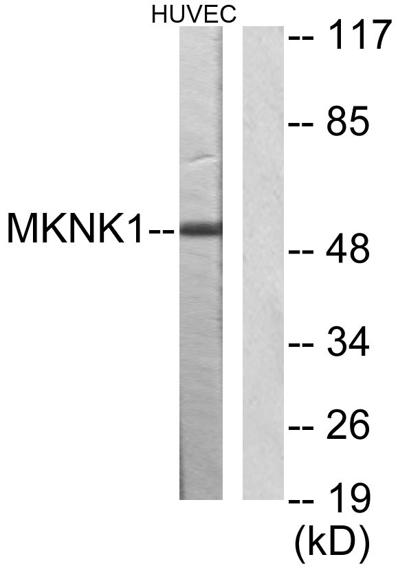 ER63984_3.jpg