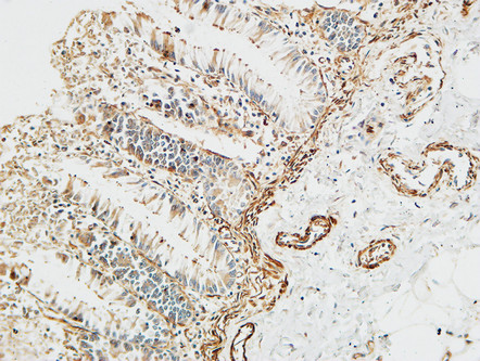 ER64704_2.JPG