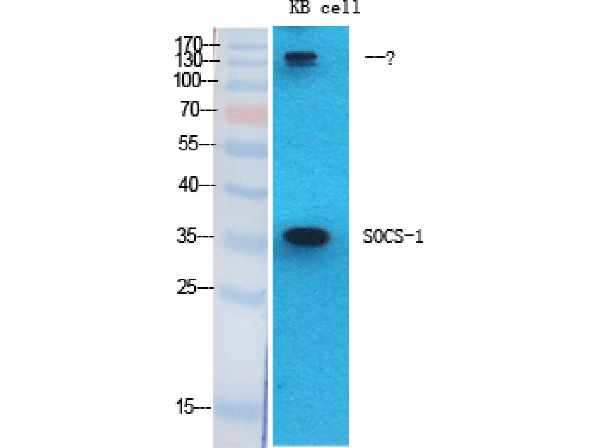 ER64997_3.JPG