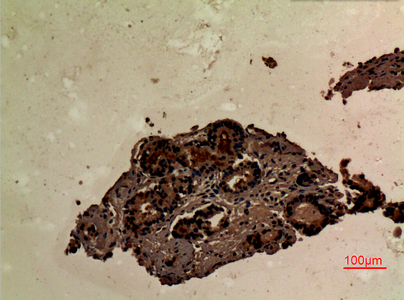 ER65421_2.jpg
