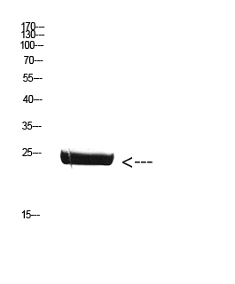 ER65738_1.JPG