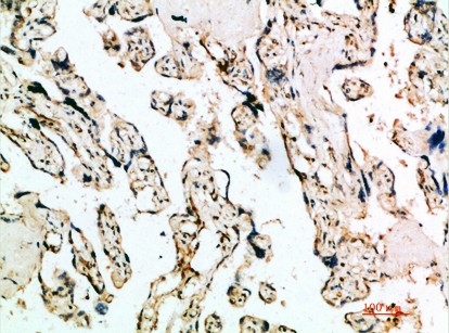 ER65794_1.jpg