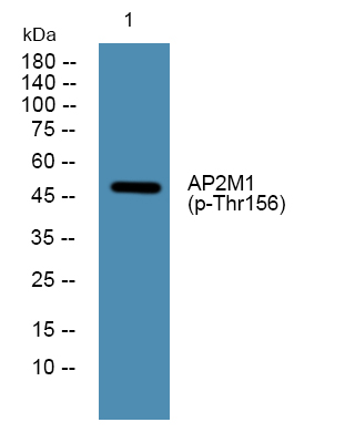 ER65961_1.jpg
