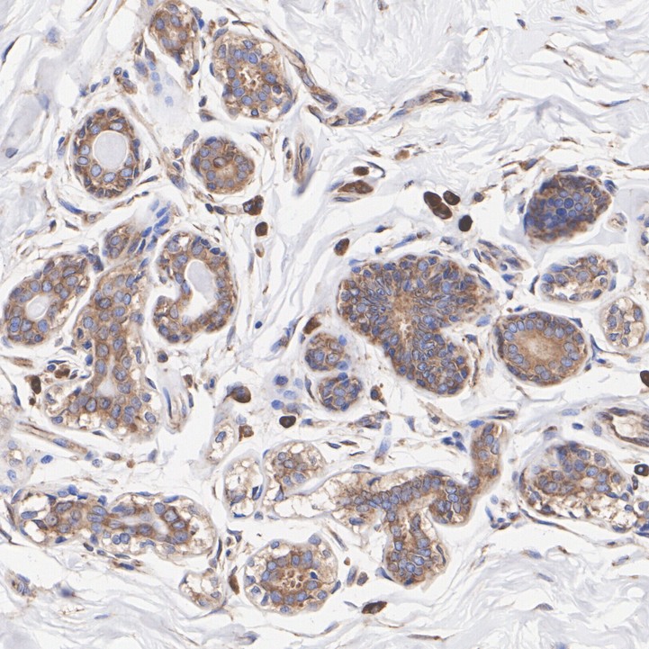 ET1604-5_5.jpg