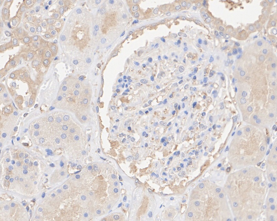 ET1605-56_10.jpg